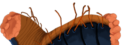 Decimillipede
